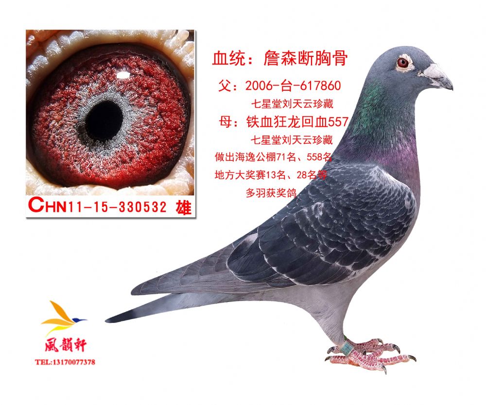 王牌断胸骨