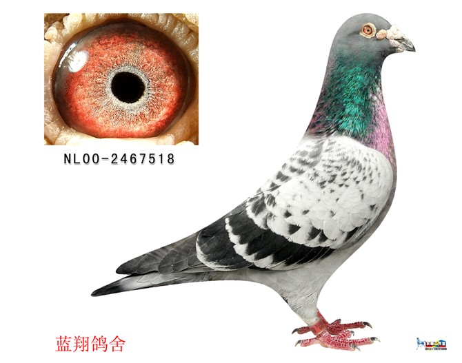 詹森断胸骨