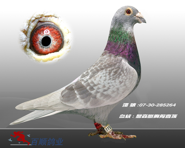 詹森断胸骨