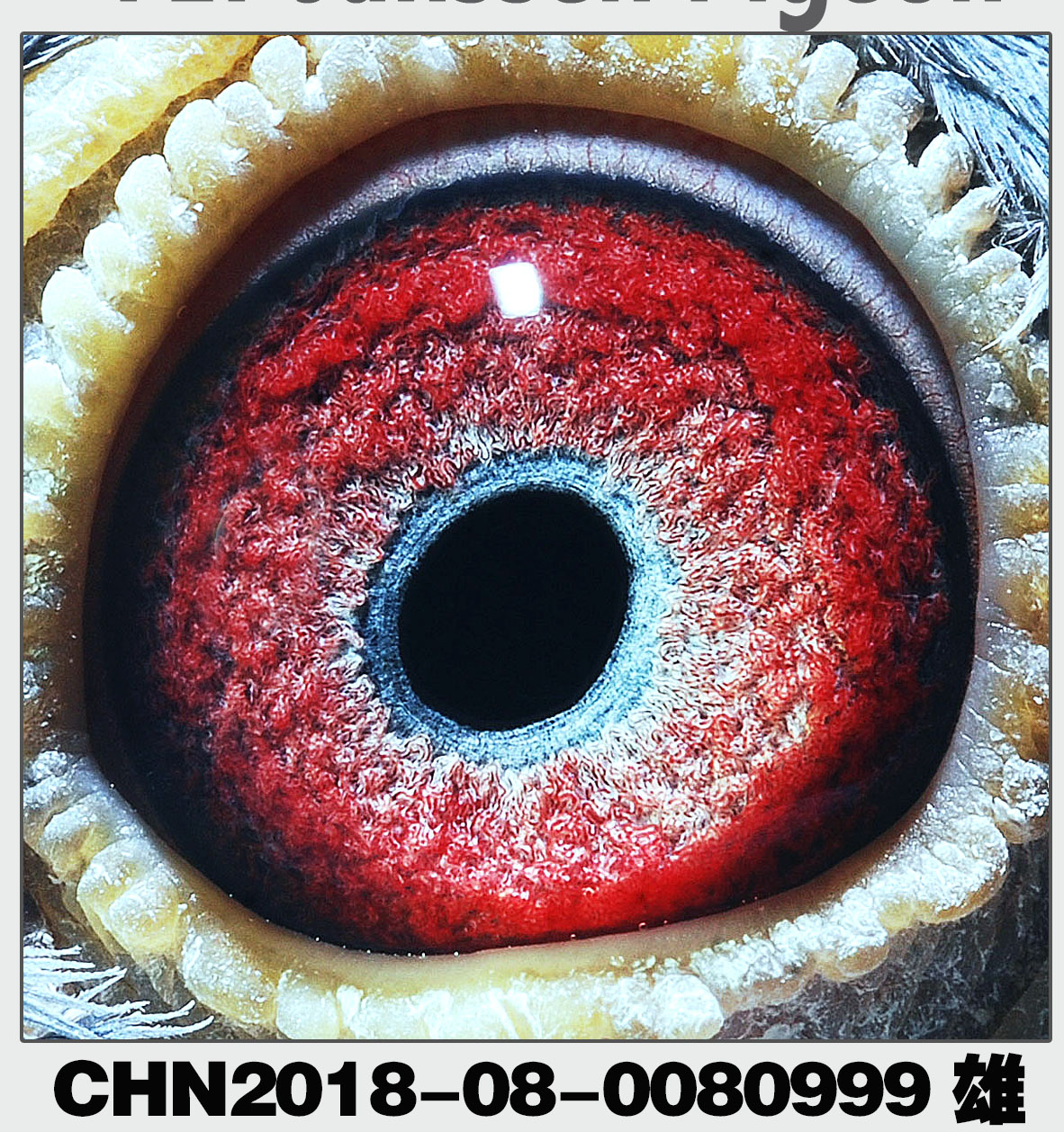 詹森019多重回血